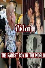 Watch Aidan The Rarest Boy In The World 0123movies