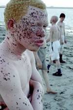 Watch Albino United 0123movies