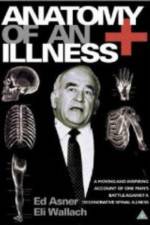 Watch Anatomy of an Illness 0123movies