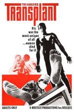 Watch The Amazing Transplant 0123movies