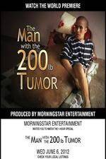 Watch The Man With The 200lb Tumor 0123movies