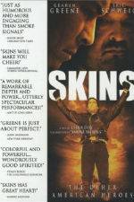 Watch Skins 0123movies