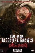 Watch TNA Wrestling: Best of the Bloodiest Brawls - Scars and Stitches 0123movies
