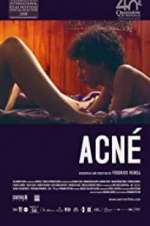Watch Acné 0123movies