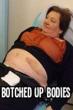 Watch Botched Up Bodies 0123movies